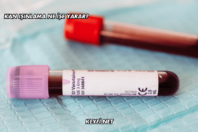 Kan Işınlama Ne İşe Yarar?