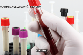 Kanı Sulandırmak Ne İşe Yarar?