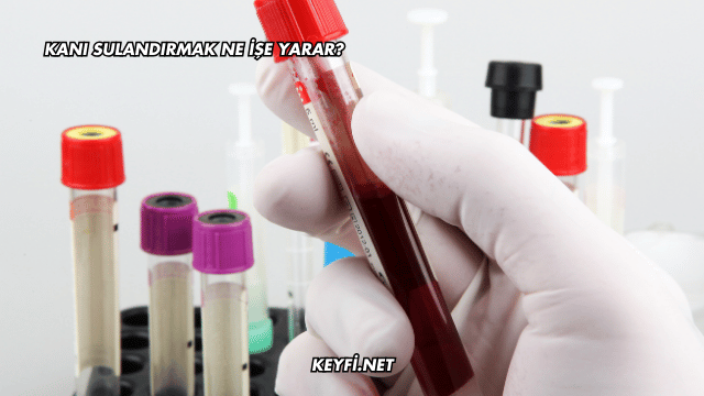 Kanı Sulandırmak Ne İşe Yarar?