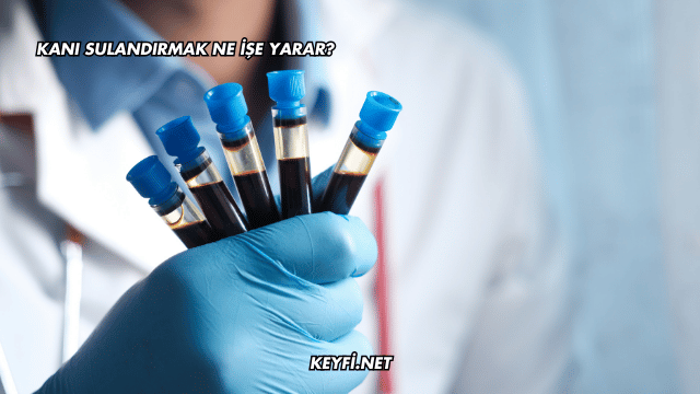 Kanı Sulandırmak Ne İşe Yarar?