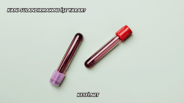 Kanı Sulandırmak Ne İşe Yarar?